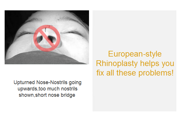 nasal problems