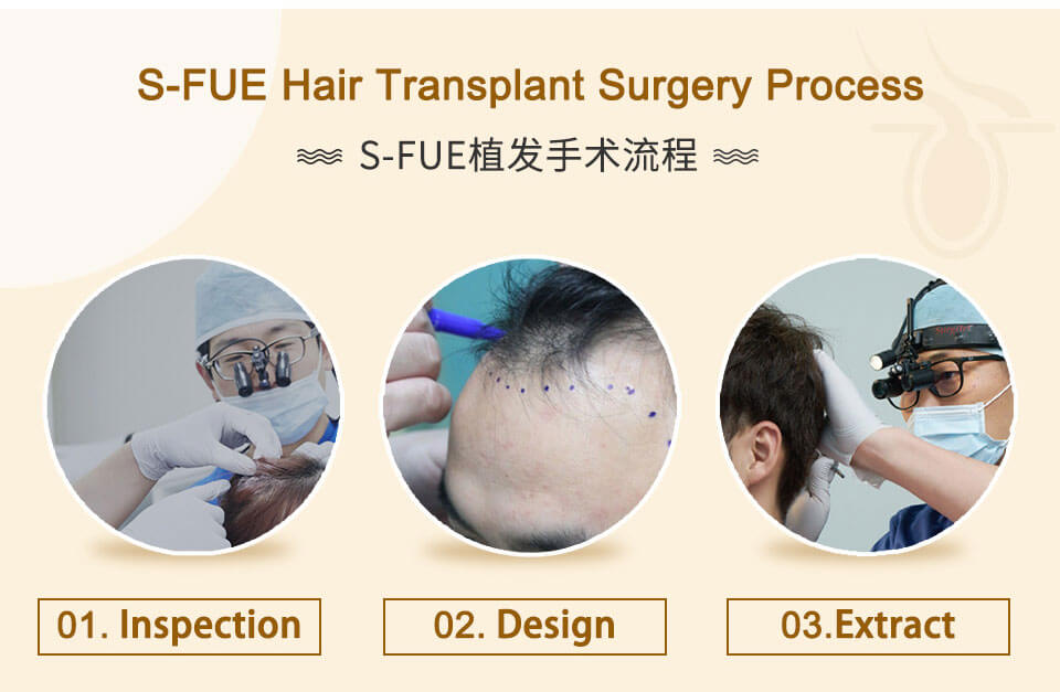 inspection , design and extract hair folicles