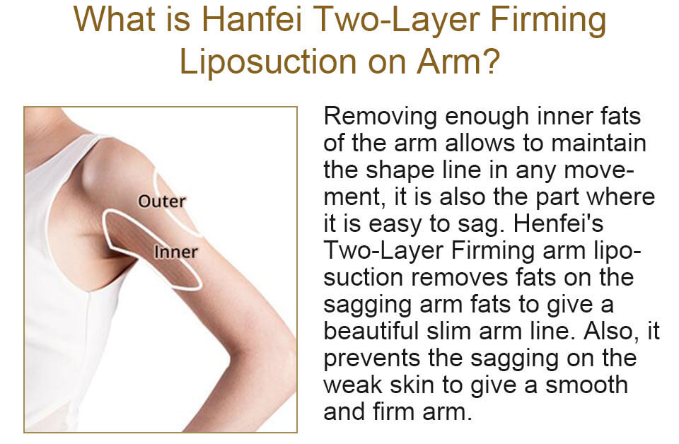what is hanfei two-layer firming arms liposuction