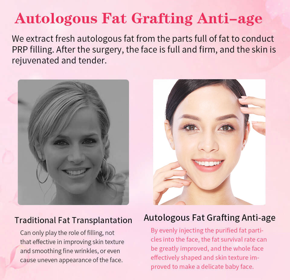 anti-aging treatments with self fat filler